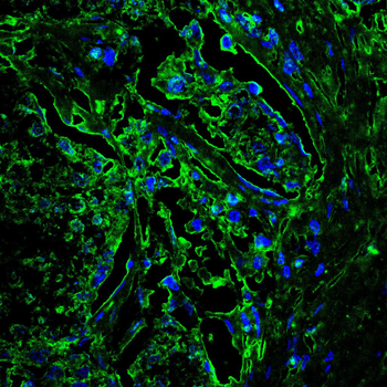 DCP1A Antibody