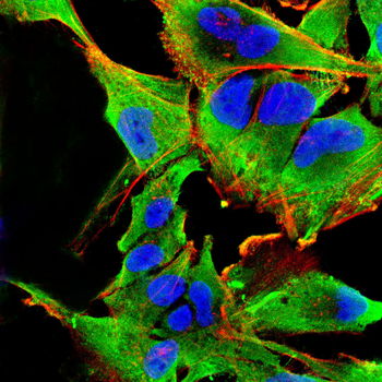 AKR1C1/AKR1C2 Antibody