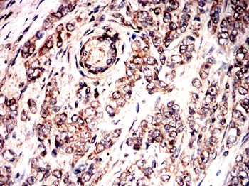 G6PD Antibody