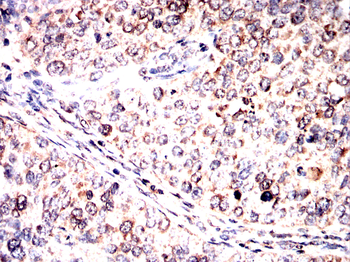 G6PD Antibody