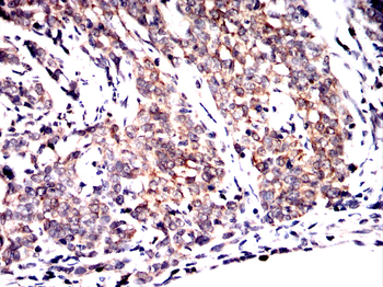 G6PD Antibody