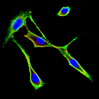 G6PD Antibody