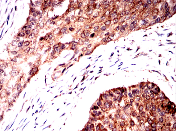 PKM Antibody
