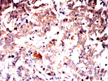PKM Antibody