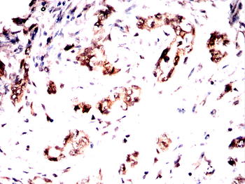 SYNE1 Antibody