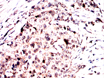 FDX1 Antibody