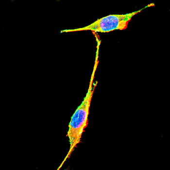 FDX1 Antibody