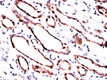 FDX1 Antibody