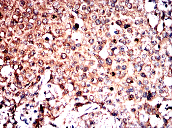 FDX1 Antibody