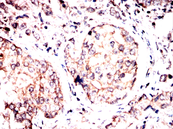 FDX1 Antibody