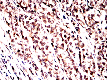 Noggin Rabbit Polyclonal Antibody