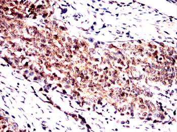 Noggin Rabbit Polyclonal Antibody