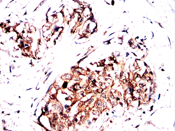 Noggin Rabbit Polyclonal Antibody