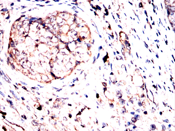 Noggin Rabbit Polyclonal Antibody