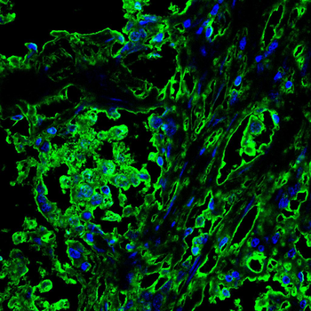 RPSA Antibody
