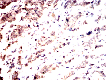 RPSA Antibody