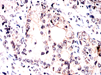 RPSA Antibody