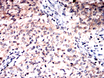 EIF2AK4 Antibody