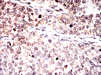 EIF2AK4 Antibody