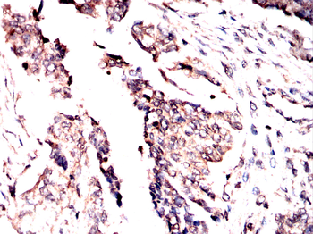 HMGCS2 Antibody