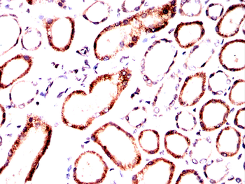 HMGCS2 Antibody