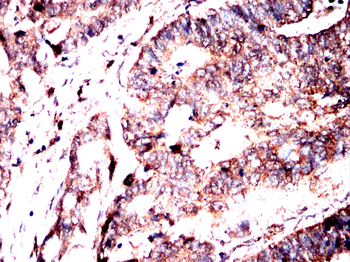 HMGCS2 Antibody