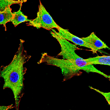ANGPT1 Antibody