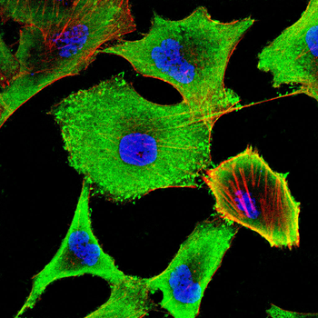 SLC1A5 Rabbit Polyclonal Antibody