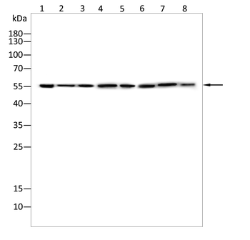 SLC1A5 Rabbit Polyclonal Antibody