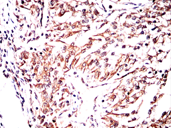 SDCBP Antibody