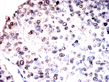 EHMT2 Antibody