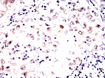EHMT2 Antibody