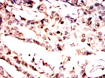 NCBP1 Antibody