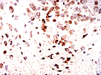 GLRA1 Antibody