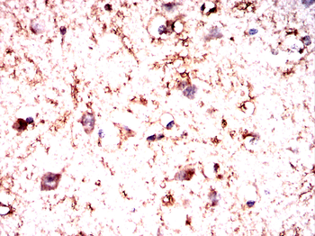 GLRA1 Antibody