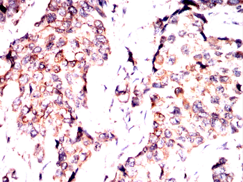 MTAP Antibody
