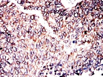 MTAP Antibody