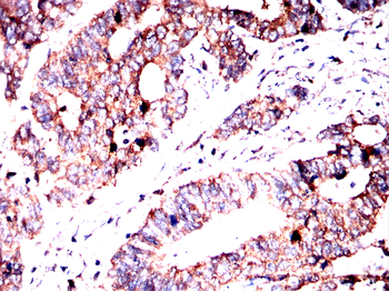 MTAP Antibody