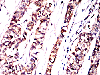 MTAP Antibody