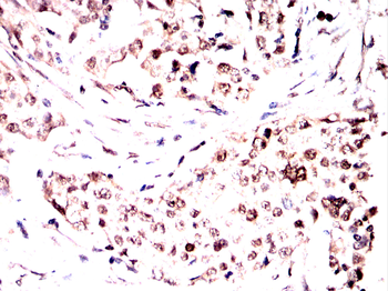CCND2 Antibody