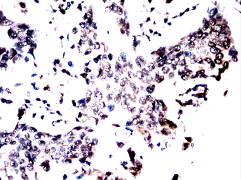 Cdkn2a Antibody