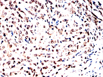 Cdkn2a Antibody