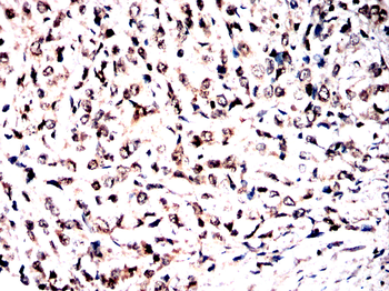 Cdkn2a Antibody