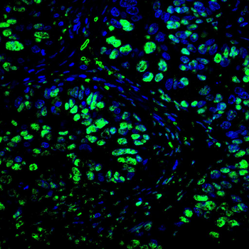 H2BC11 Antibody