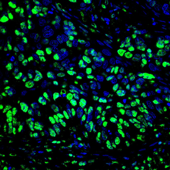 H2BC11 Antibody