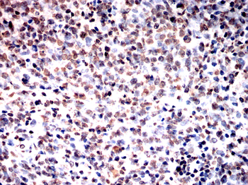 H2BC11 Antibody