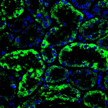 MAOB Antibody