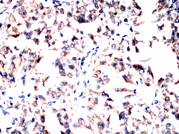 MAOB Antibody