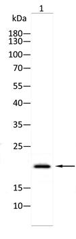 PTGDS Antibody