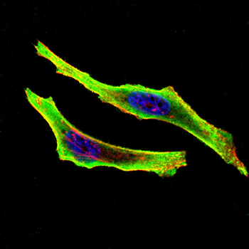 PTGDS Antibody